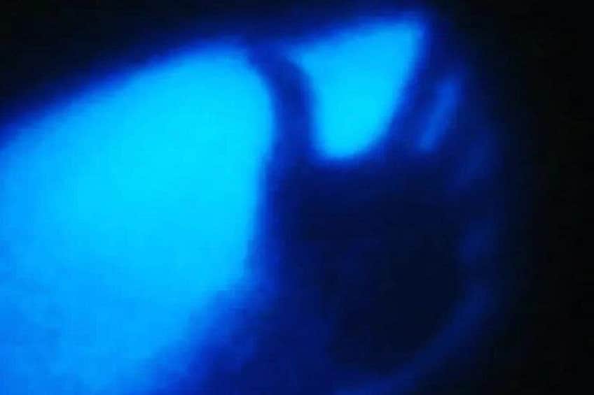 Une source de lumière bleue entourée d’une zone sombre. 5