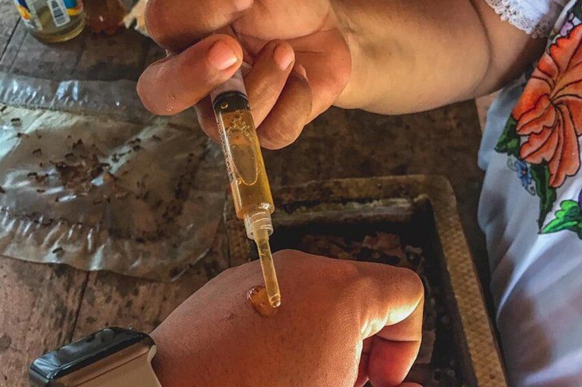 A person holding a syringe with a yellowish liquid. 4