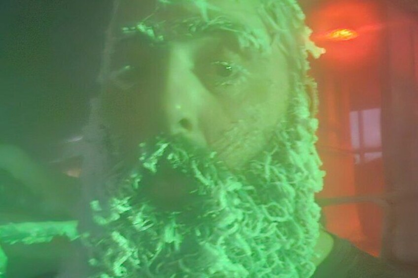 A person with a textured, possibly furry, garment. 2