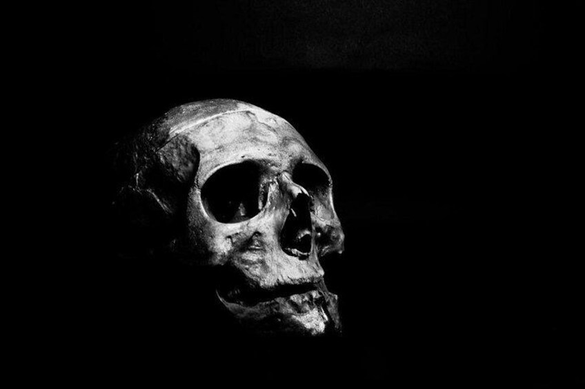 A skull. 5
