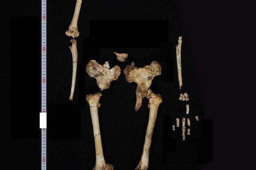 A collection of fossilized bones, including a femur and pelvis, displayed against a dark background with a ruler for scale. 2