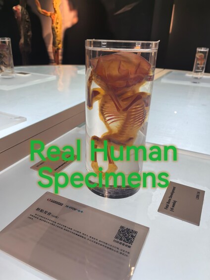 A display case containing a human skeleton specimen. 1
