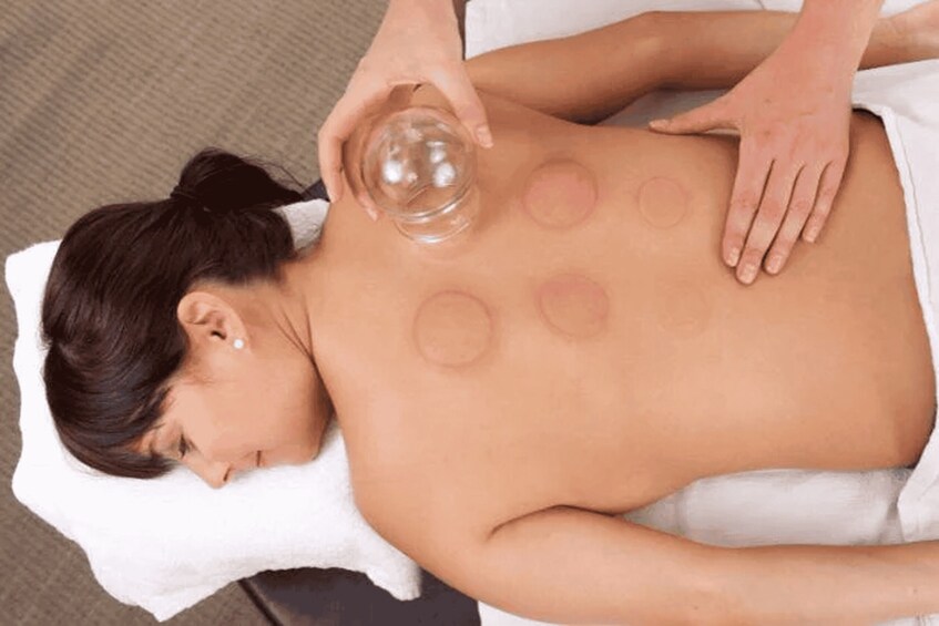 A person receiving a back massage with circular pressure points marked on the skin. 2