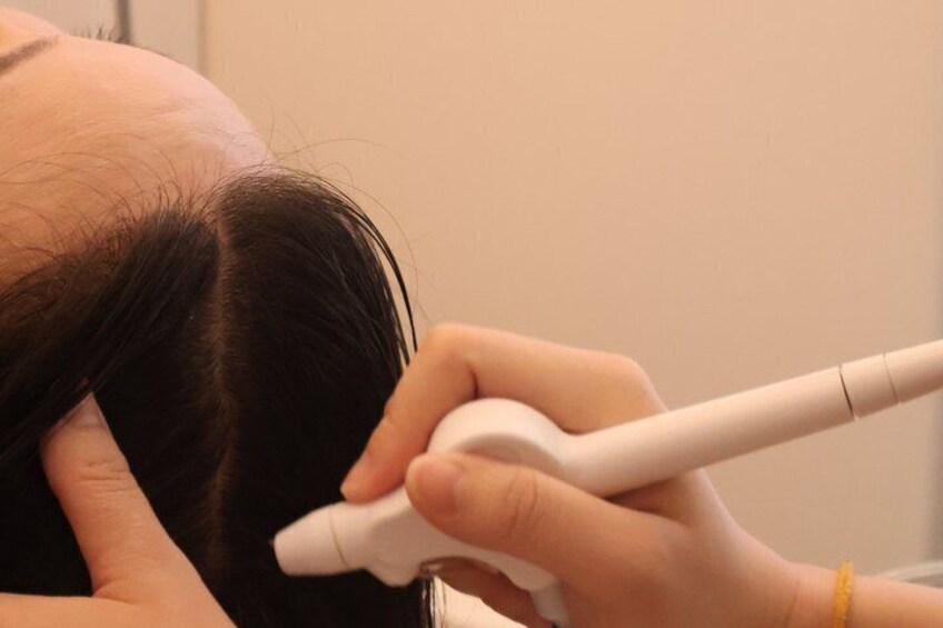 A person receiving a medical procedure with a white device on their head. 2