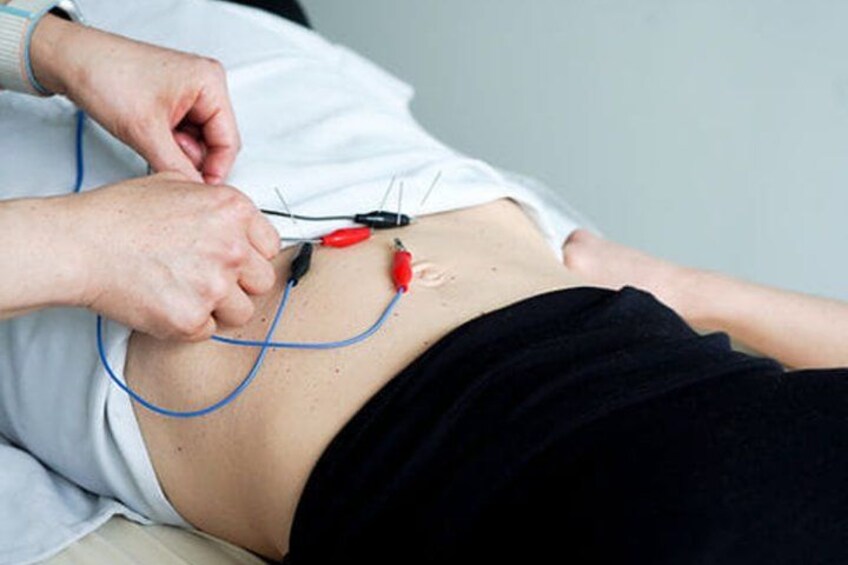 A person lying down with electrodes attached to their abdomen, connected by wires. 3