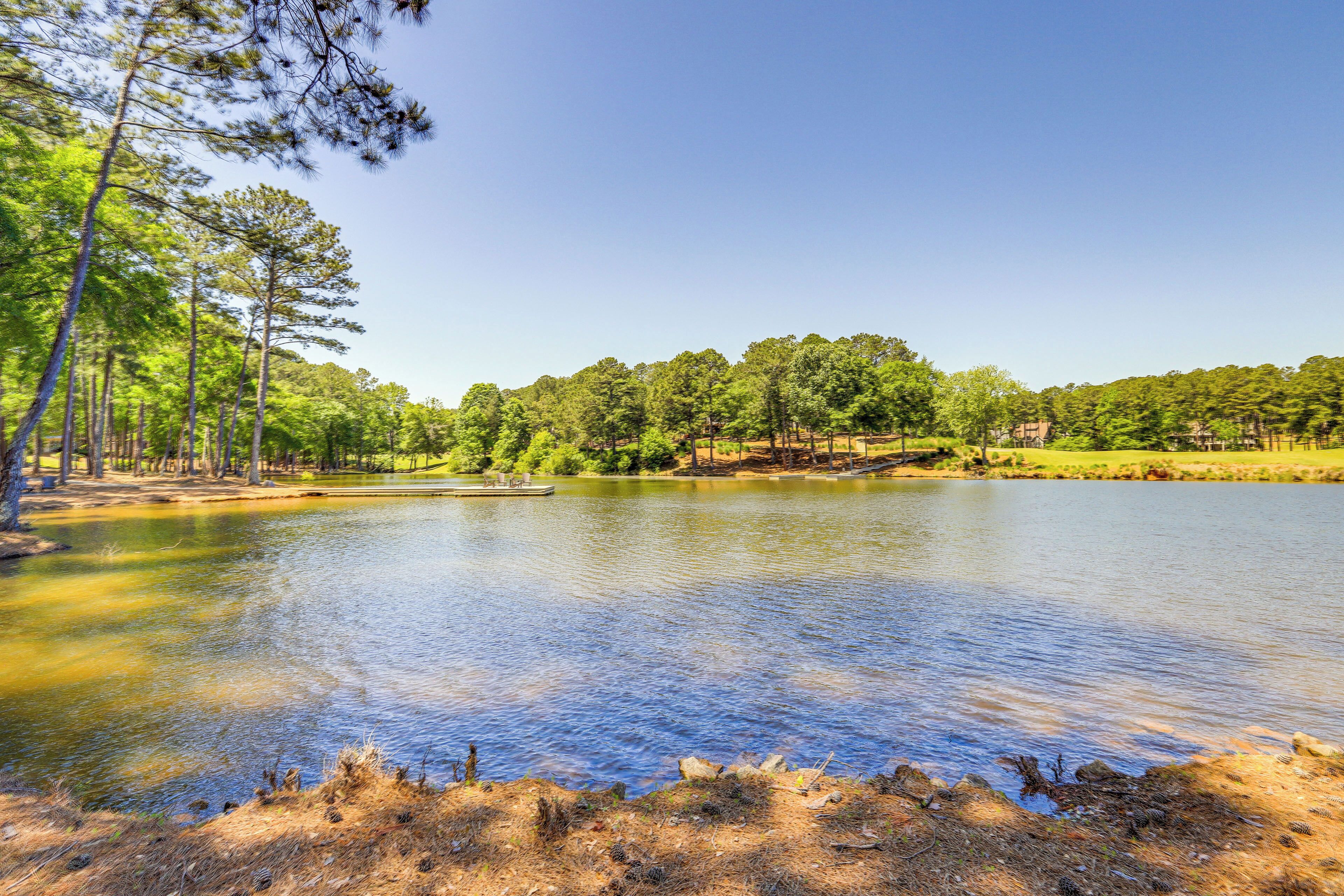 A serene lake surrounded by trees and a grassy area.