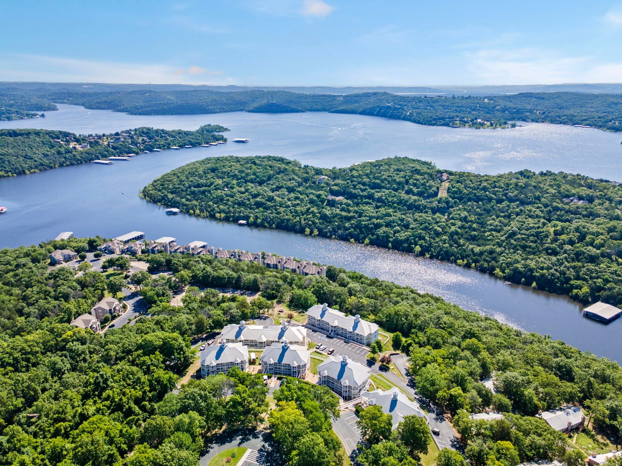 An aerial view of a resort with multiple buildings, a lake, and surrounding forested areas.