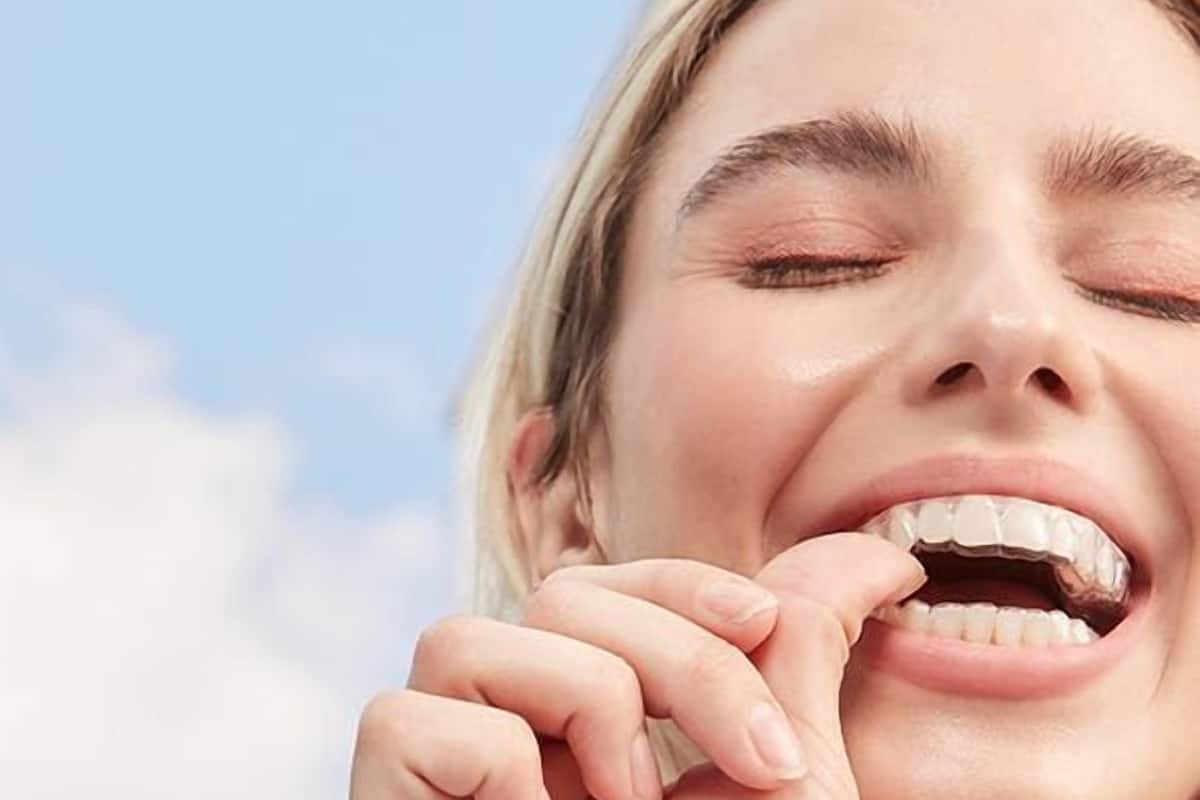 Dental Program Timeless Implants Journey