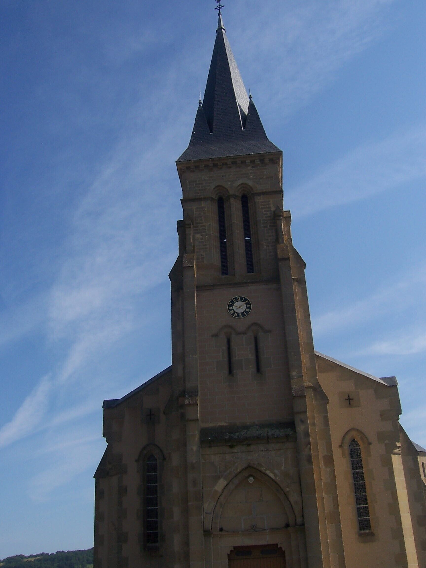 Severdighet