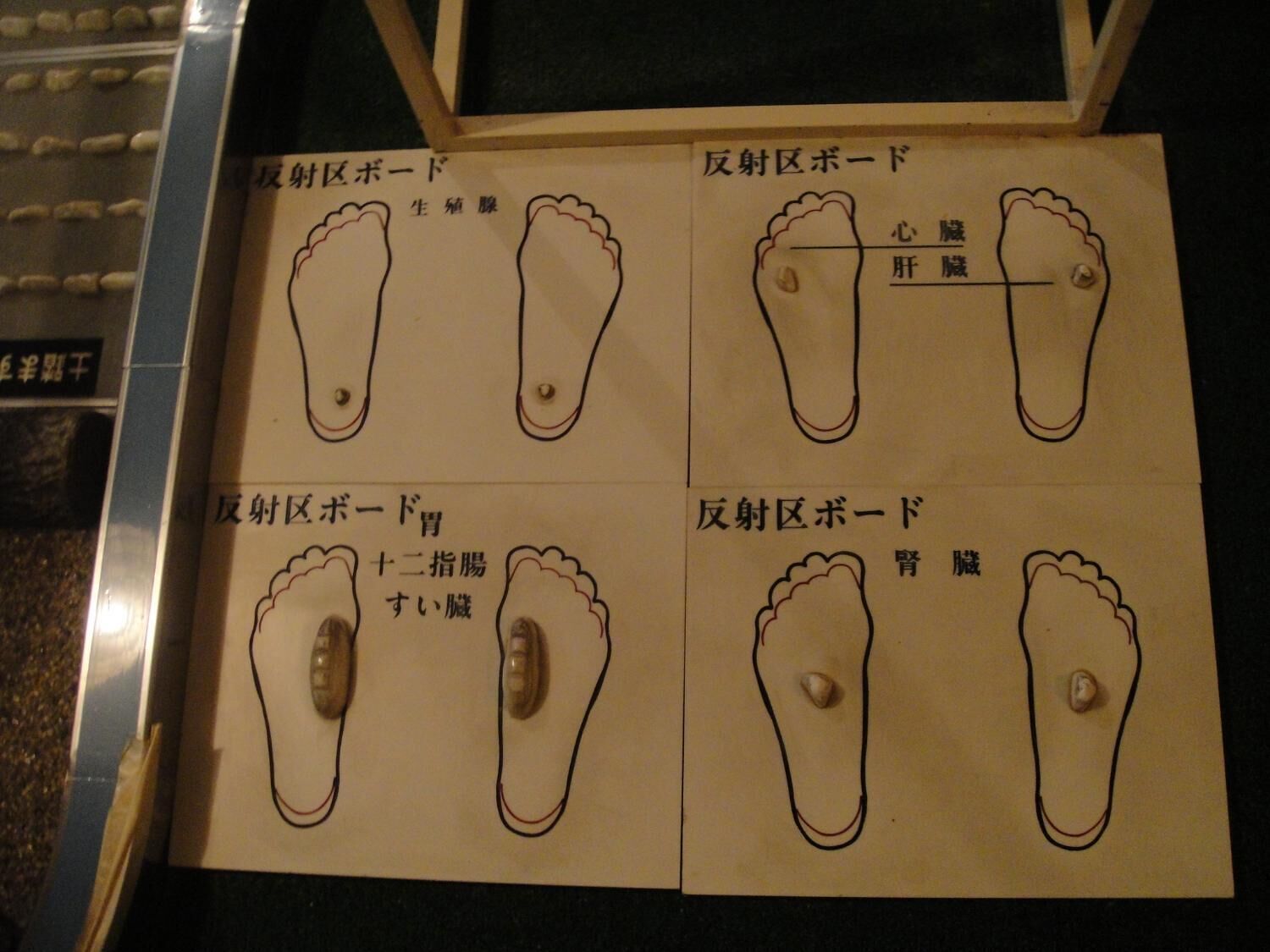 Un diagrama con siluetas de pies y etiquetas en japonés, probablemente explicando un procedimiento de cuidado del pie o médico.