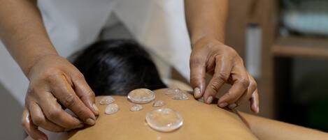 A massage with circular objects on a person's back.
