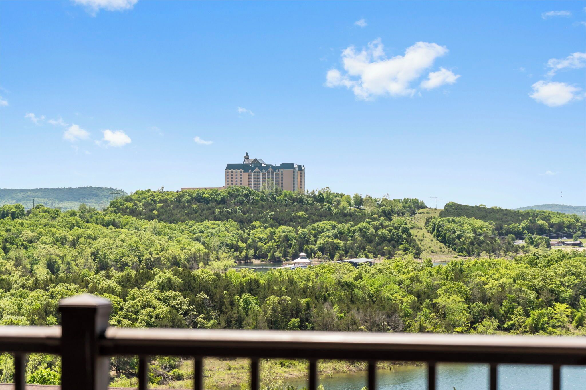 A hotel on a hill with a view of a lake and forested area.