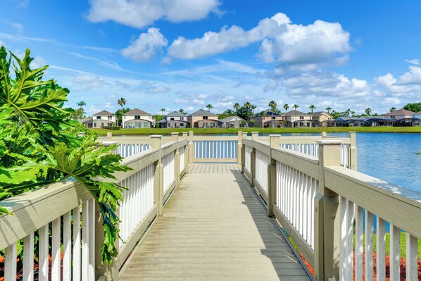 A wooden boardwalk leading to a row of houses by a lake.