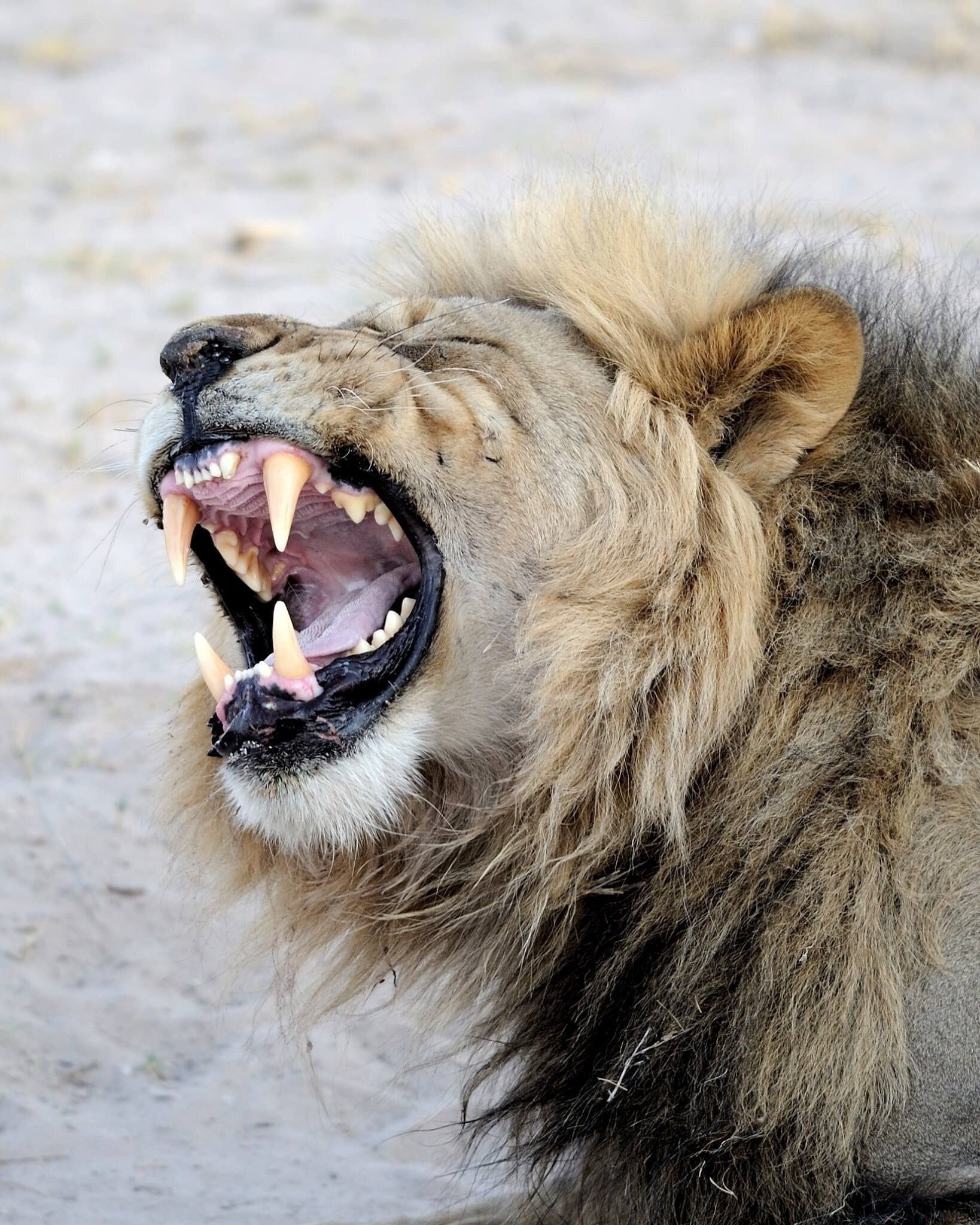 I need a dentist !!!!!