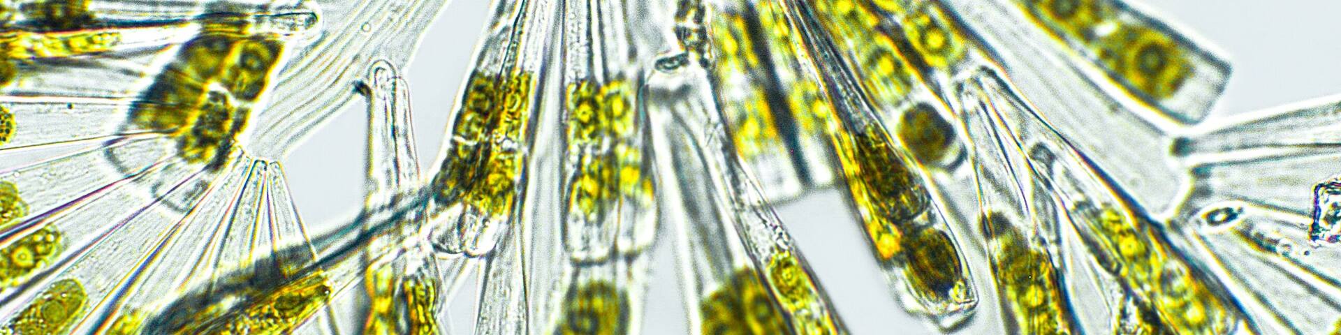 Licmophora sp. algae, marine and freshwater diatom under microscopic view. Genus of benthic, photosynthetic and epiphyte diatom
